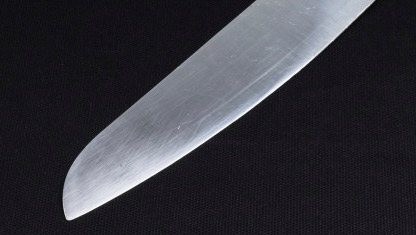 Una brasileña estuvo 37 años con un trozo de cuchillo clavado en un hombro