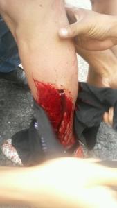 GNB arremete contra manifestantes en Rubio (Fotos)