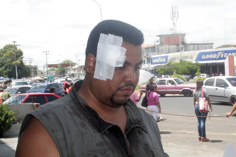 Hombre fue herido por un GNB por defender a mujer en supermercado