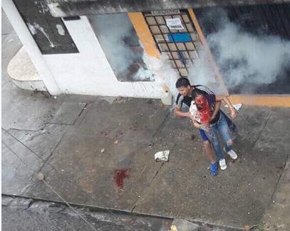 Joven atacada por la GNB en Táchira, tiene un perdigón alojado en el cerebro