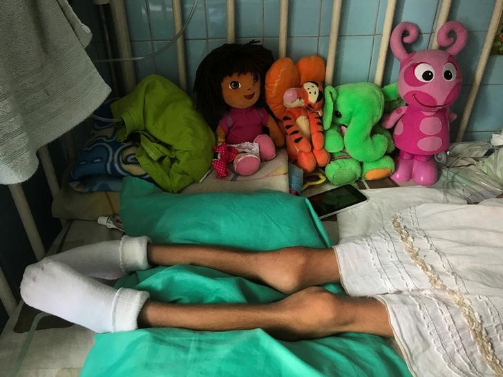 Desnutrición infantil en Venezuela puede alcanzar el 25% este año