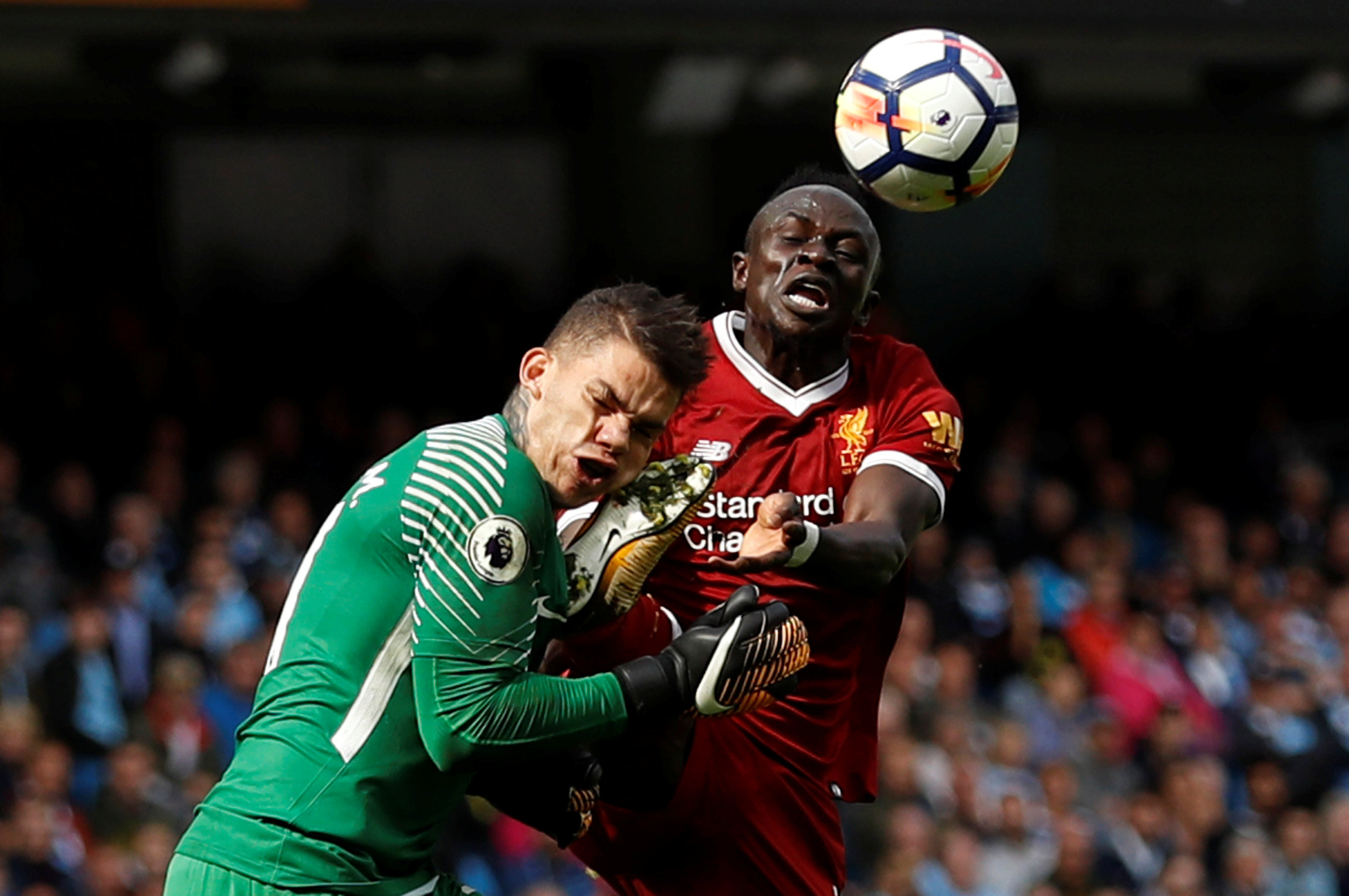 Así quedó el portero del Manchester City tras recibir una patada en la cara (foto y video)