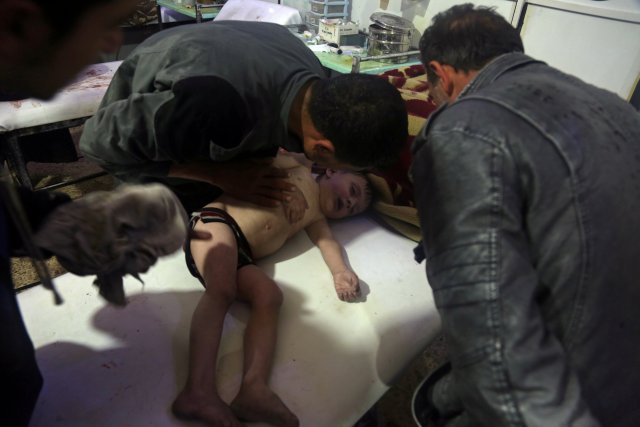 A child is treated in a hospital in Douma, eastern Ghouta in Syria, after what a Syria medical relief group claims was a suspected chemical attack April, 7, 2018.  Pcture taken April 7, 2018.   White Helmets/Handout via REUTERS   ATTENTION EDITORS - THIS PICTURE WAS PROVIDED BY A THIRD PARTY. REUTERS IN UNABLE TO VERIFY THE AUTHENTICITY, CONTENT, LOCATION OF THIS IMAGE.  NO RESALES. NO ARCHIVES.
