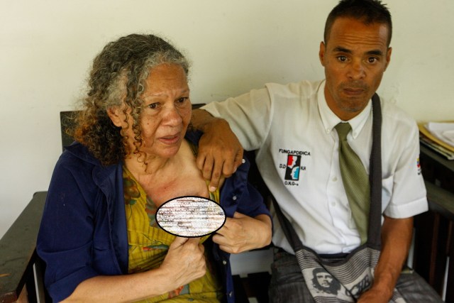 Fotografía del 7 de junio de 2018 de la señora Elizabeth Salazar (i), paciente de cáncer de seno, y su esposo, Luis Escobar, durante una entrevista con Efe, en Caracas (Venezuela). Venezuela está conmovida con el cáncer de seno de Elizabeth Salazar, una ciudadana natural del estado de Anzoátegui (este) que se ha aferrado a su fe y a la solidaridad de la gente, ante los oídos sordos del Gobierno de Nicolás Maduro que se ha negado a escuchar su lamento público. EFE/Edwinge Montilva