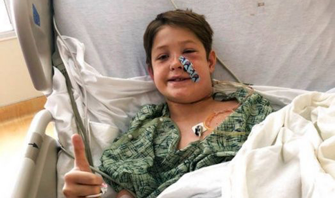 Un milagro… Niño estadounidense sobrevive luego que una brocheta le atravesó la cabeza (FOTO)