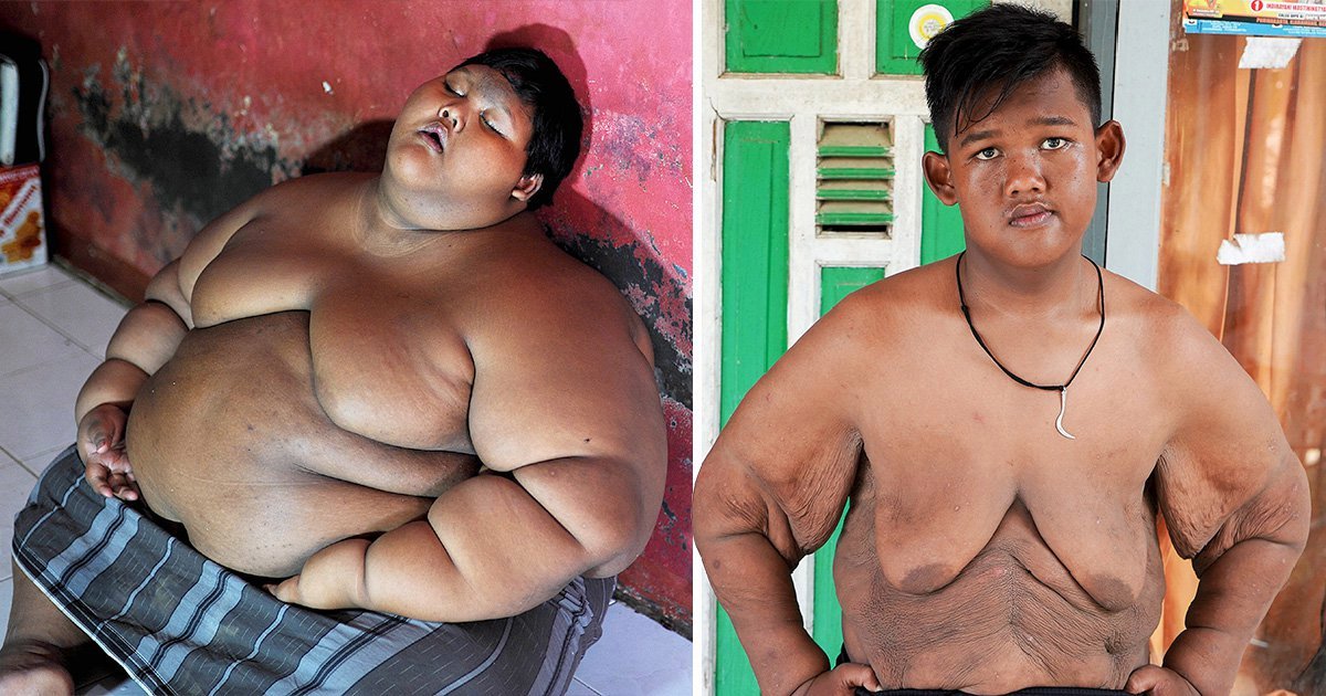 Así luce ahora el niño más pesado del mundo después de perder 100 kilos (video)