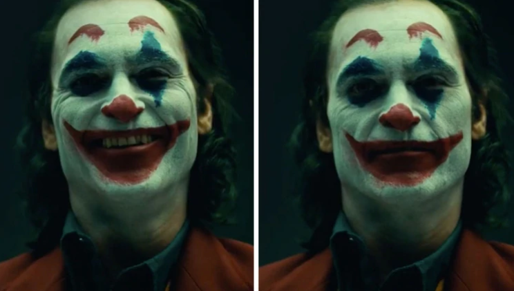 ‘Joker’: ¿Realmente existe la enfermedad que sufre el protagonista?