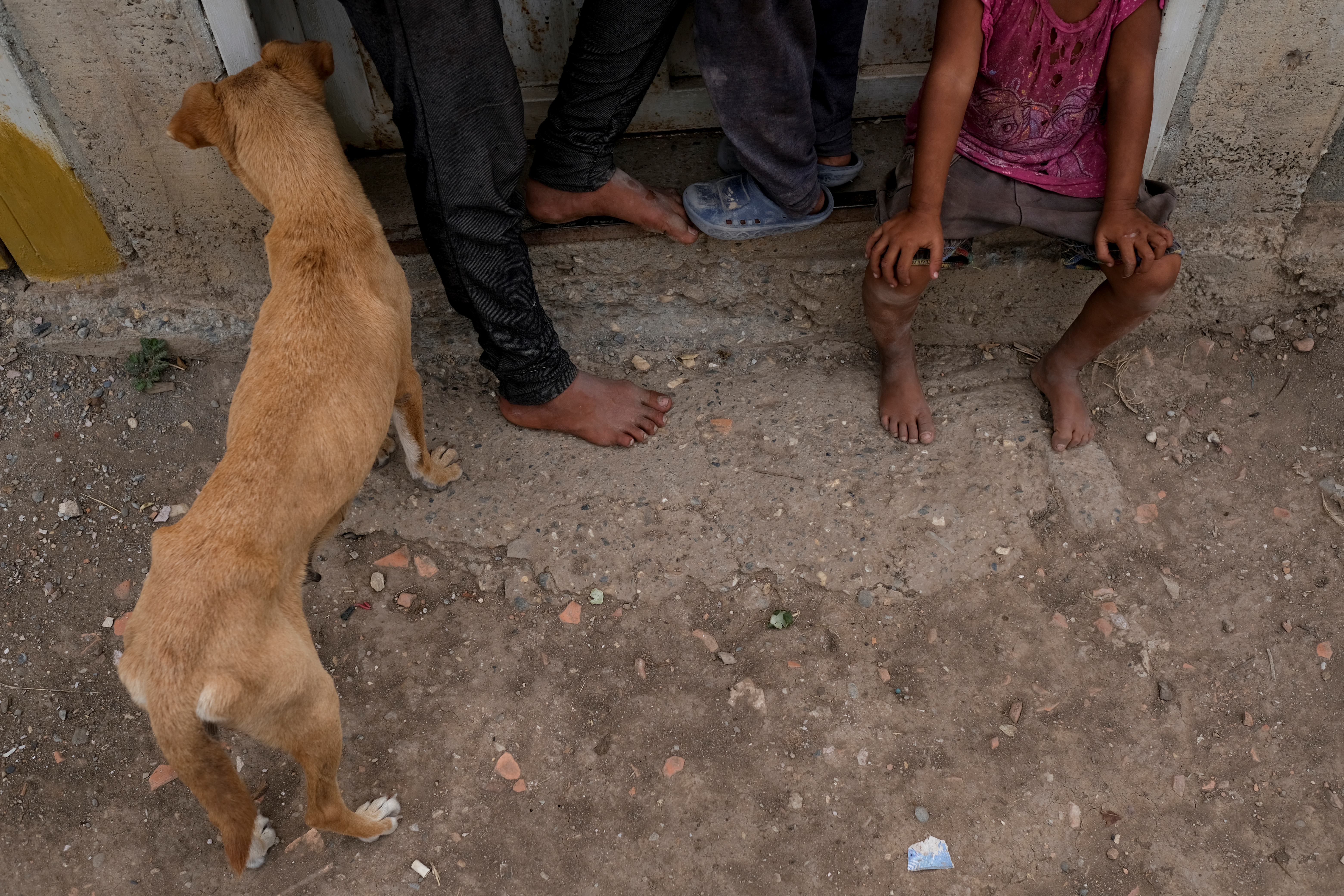 EN FOTOS: La desnutrición infantil azota los hogares más humildes de Venezuela