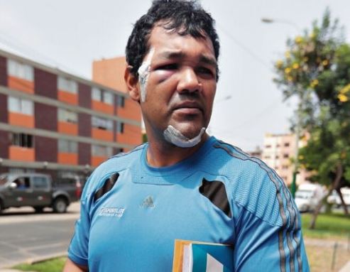 Venezolanos en Perú golpearon salvajemente a hombre que les llamó la atención por orinar en la calle