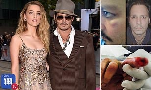 PRUEBAS: Amber Heard golpeó y le cortó el dedo a Jhonny Deep