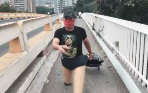 Testigo Directo: El hombre cangrejo de Venezuela (VIDEO)