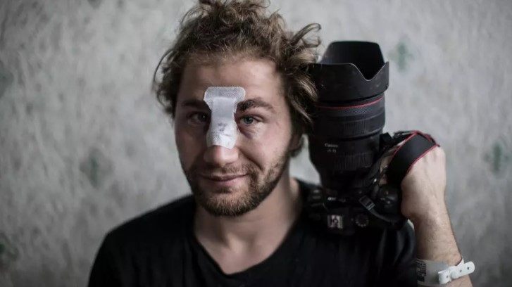 Fotógrafo herido en manifestación revive en París momentos de la guerra siria