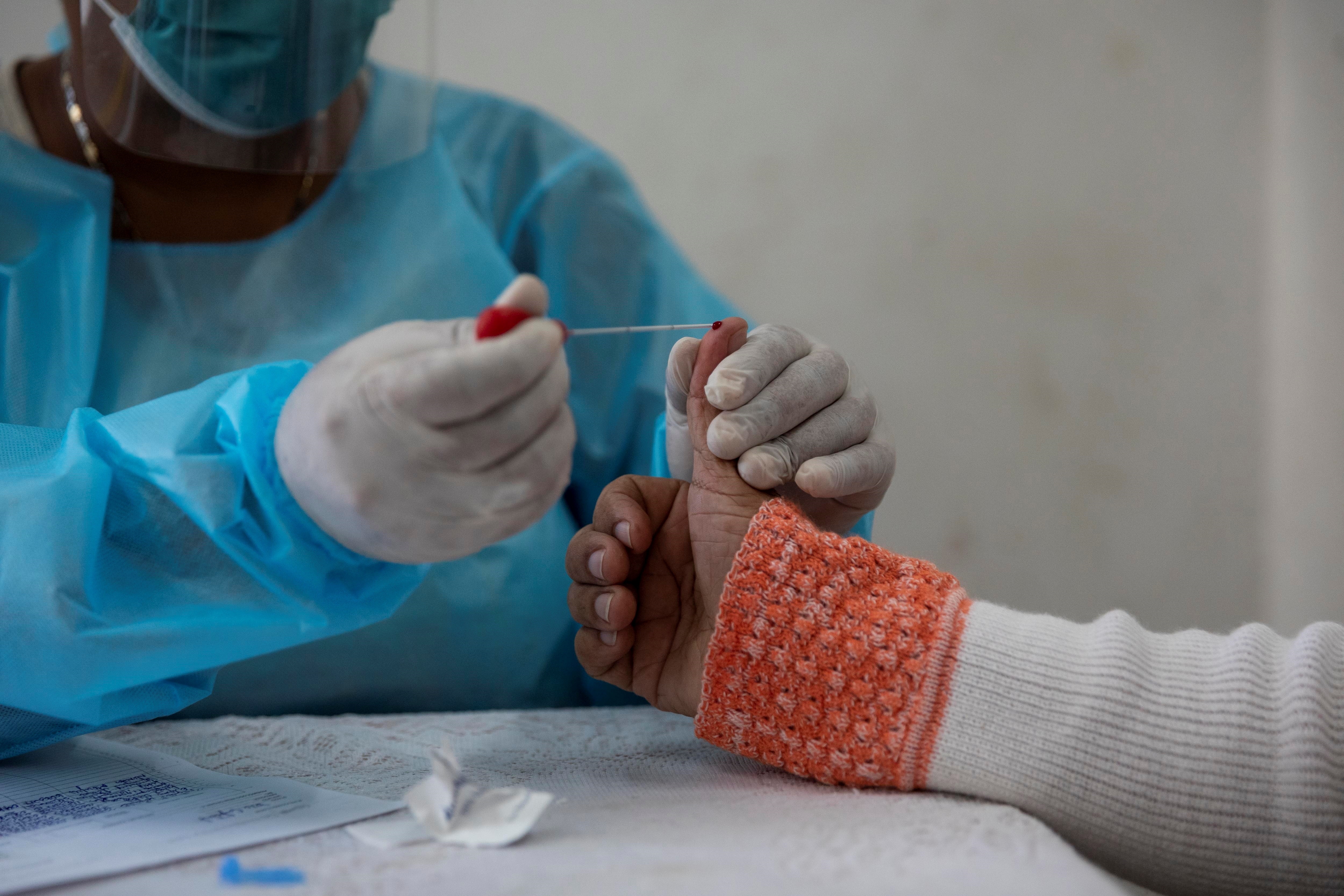 Venezuela supera los 155 mil casos por coronavirus, según cifras del régimen