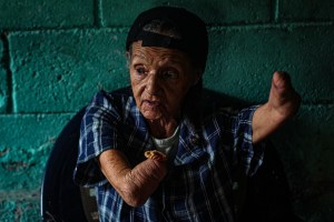 Consuelo, la abuela sin brazos que lucha contra la crisis en el barrio más peligroso de Venezuela (Video)