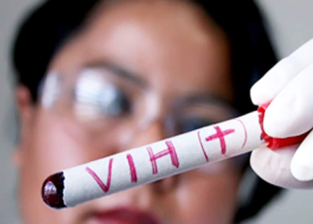 Descubren una nueva variante del VIH, con mayor virulencia y más perjudicial para la salud
