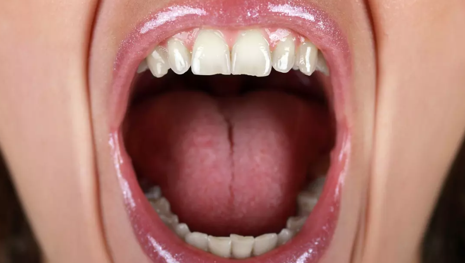 ¿Tienes siempre la boca seca? Así es la xerostomía, el síndrome que afecta a la saliva