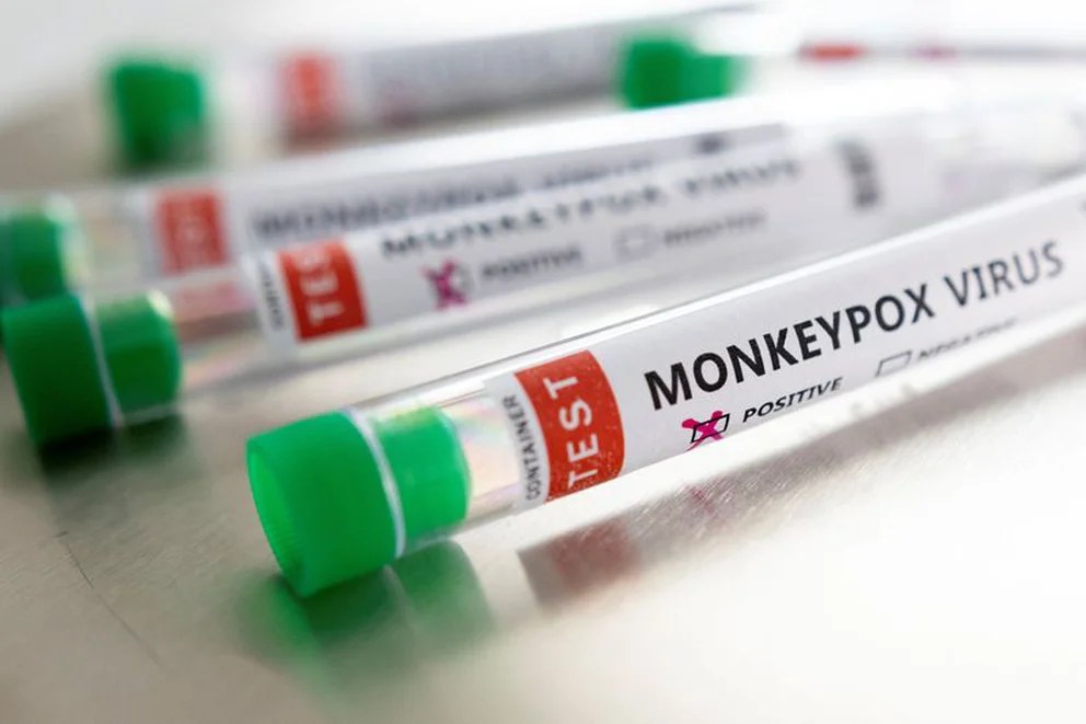 Vacunación en anillo: La estrategia para combatir la viruela del mono en el mundo