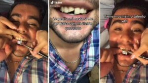 Se le quebró un diente y su novia encontró una increíble solución casera que se volvió viral