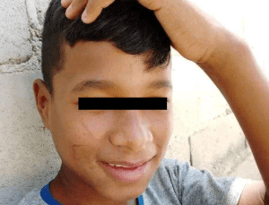 Adolescente murió en presunto enfrentamiento con la policía mientras recogía chatarra en Carabobo