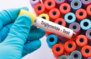 Cuáles son las causas de tener triglicéridos altos y cuáles son los niveles considerados normales